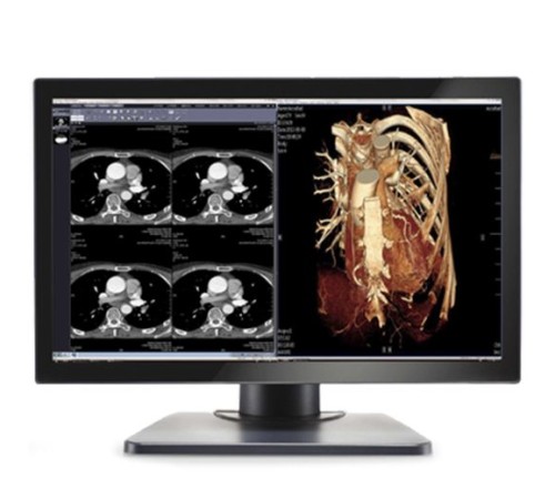 Double Black Imaging Image Systems Gemini 4MP Large Format Display